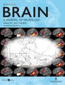 Brain